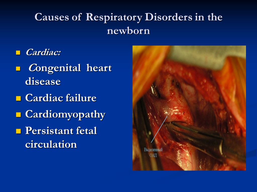 Causes of Respiratory Disorders in the newborn Cardiac: Congenital heart disease Cardiac failure Cardiomyopathy